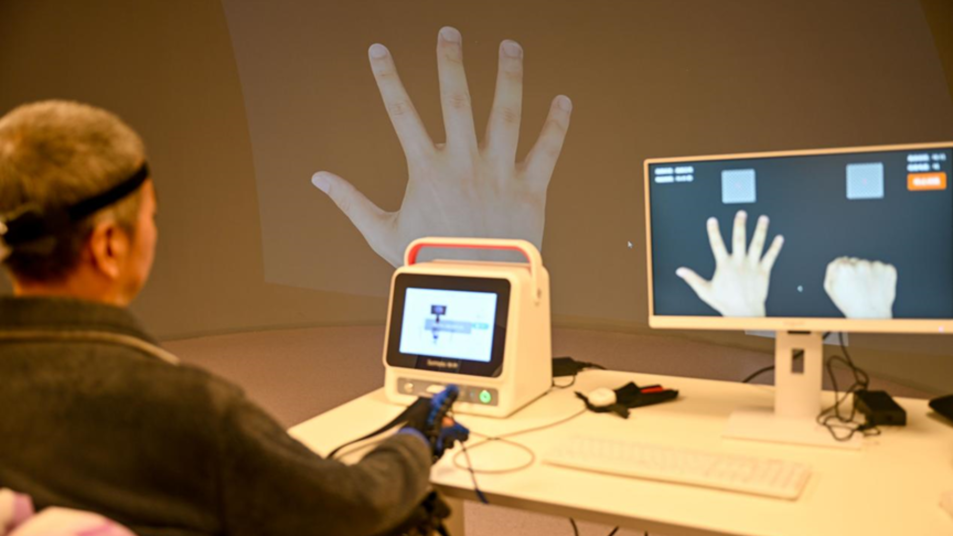 A patient uses an implantable brain-computer interface to control a digital hand via neural signals.